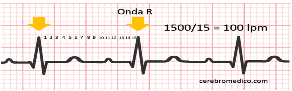 <p>Contar el número de cuadros pequeños entre dos complejos QRS consecutivos. Usar como guía la onda R de cada QRS y dividir ese número por 1500.</p>
