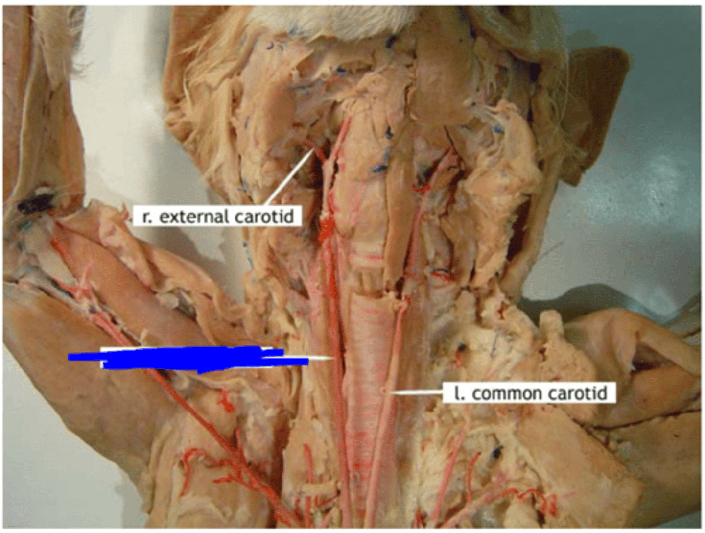 <p>along the right side of the trachea</p>
