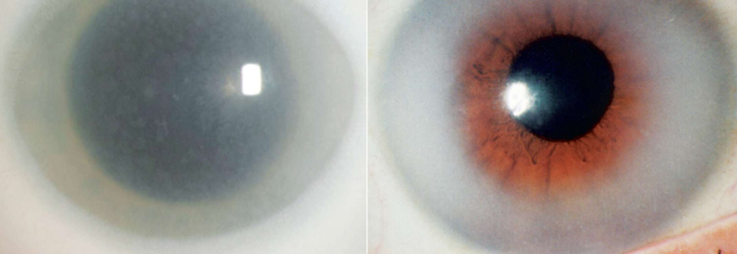<p>What condition is this?</p>