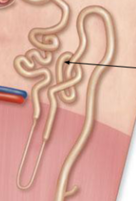 <p>DCT Hi<strong>stology:</strong> </p><p></p>