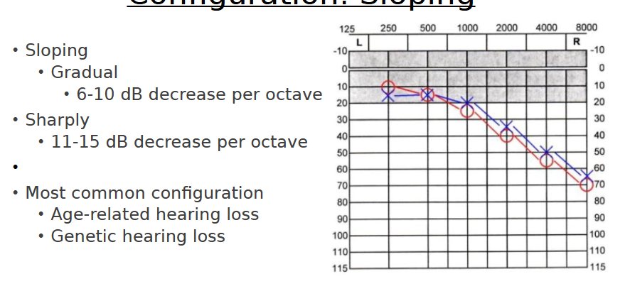 <p>“Normal sloping to moderately severe hearing loss bilaterally</p><p>Normal hearing sensitivity through 500 Hz sloping to severe in the right ear</p><p>Normal hearing sensitivity through 1000 Hz sloping to severe in the left ear”</p>