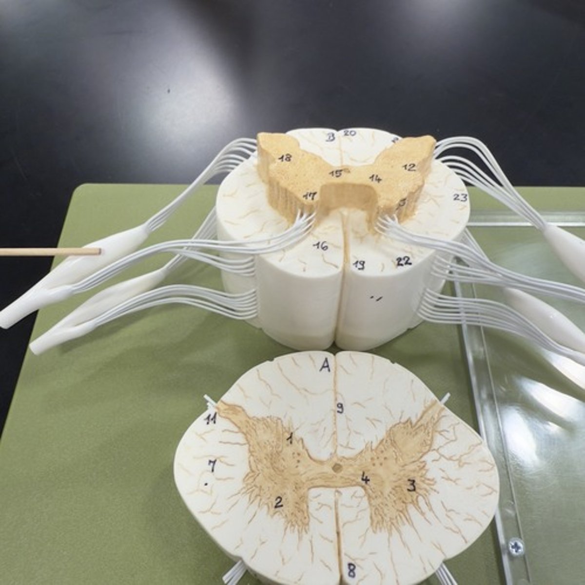 <p>Identify the structure.</p>