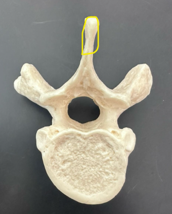 <p>What is circled in yellow?</p>