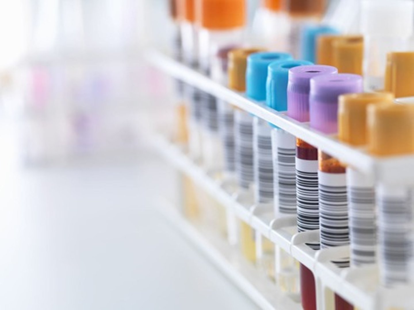 <p>Complete blood count, serum electrolytes, blood urea nitrogen, creatinine levels, urine pH, specific gravity, and arterial blood gases.</p>
