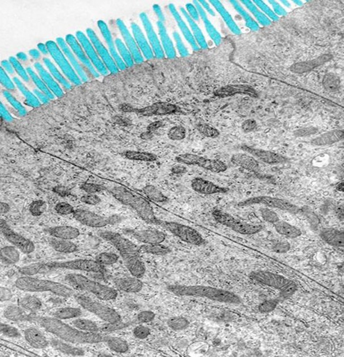 <p>Identify these cellular structures.</p>