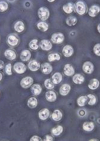 <p><span style="background-color: transparent;"><strong><span>Cryptosporidiosis</span></strong></span></p>