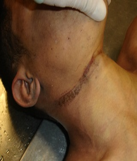 <p><span>Diagnosis<br>Describe the neck injury</span></p>