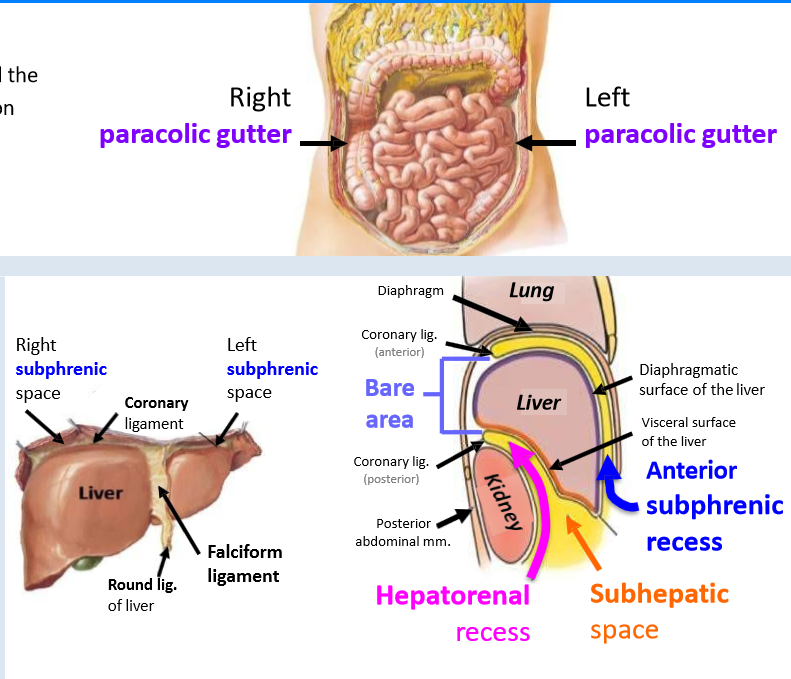 <p>Paracolic gutters: between the abdominal wall and the lateral aspect of the ascending or descending colon</p><p>Subphrenic recesses: Located below the diaphragm</p><p>Subhepatic space: Immediately inferior to the liver</p><p>Hepatorenal recess: Extension of the subhepatic space between the visceral surface of the liver and the right kidney</p>