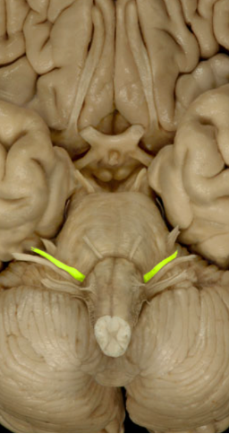 <ul><li><p>Controls facial expression (Motor)</p></li><li><p>Salivary glands </p></li></ul><p></p>