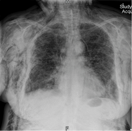 <p>What is this pathology?</p>