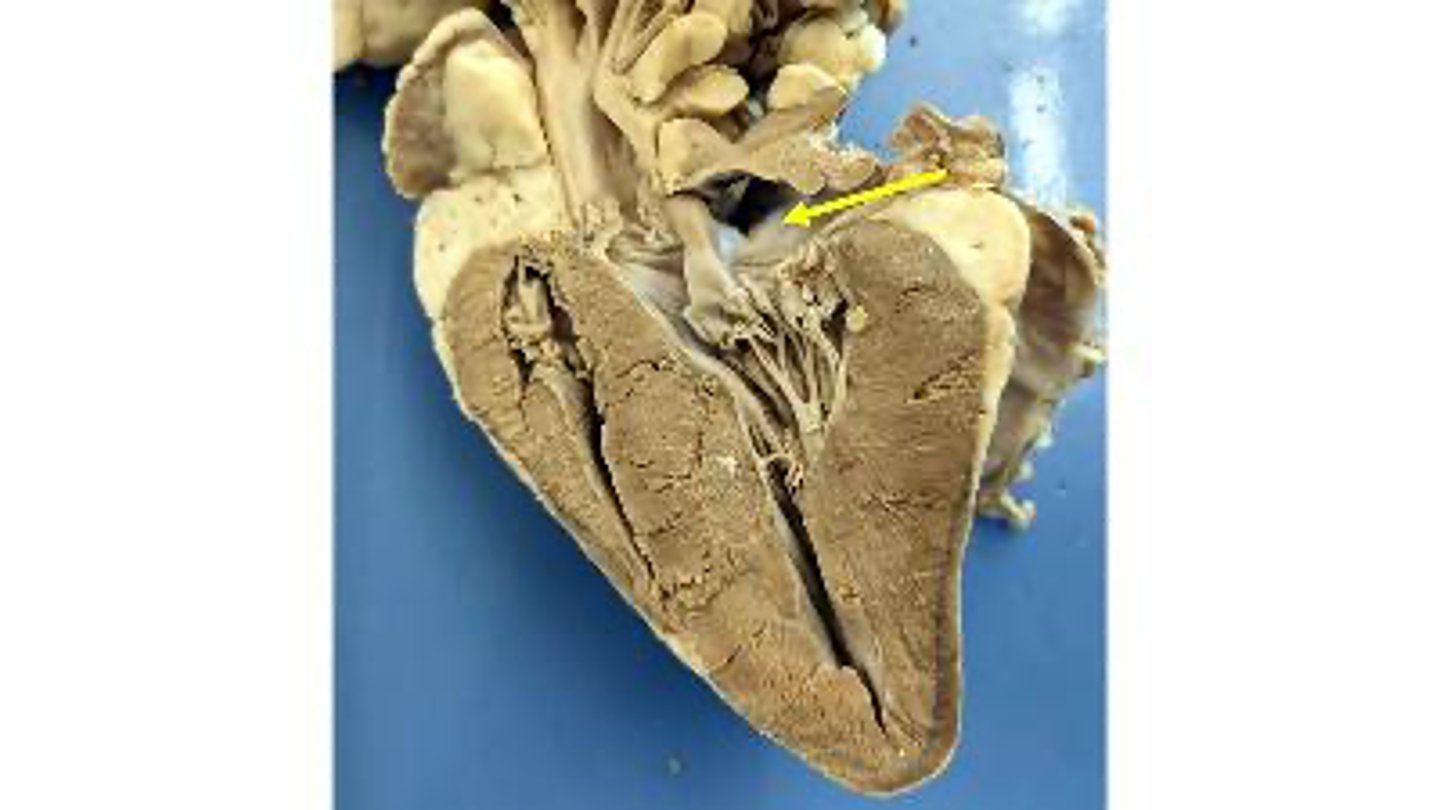 <p>Name the chamber</p>