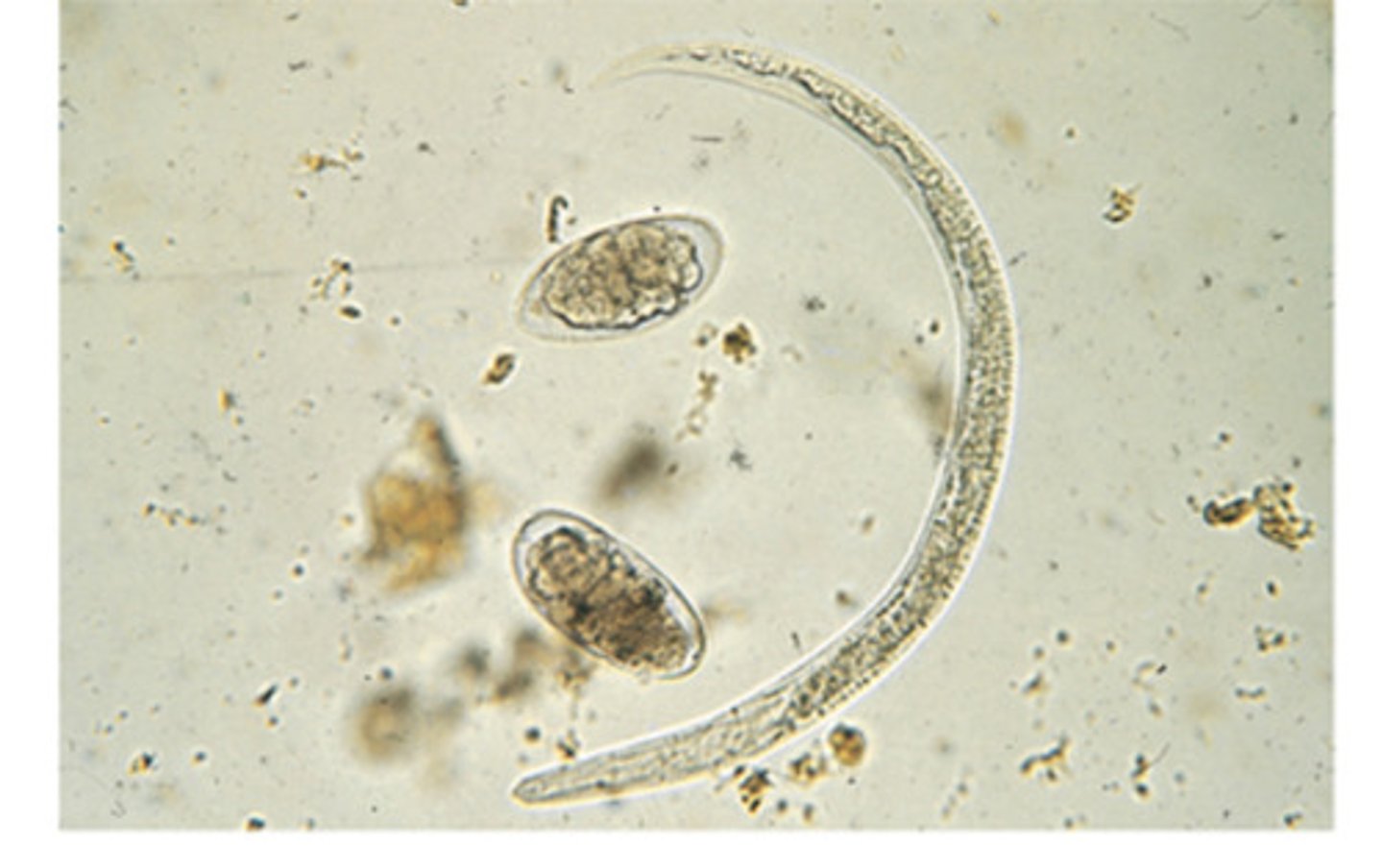<p>Lungworm of cattle</p>