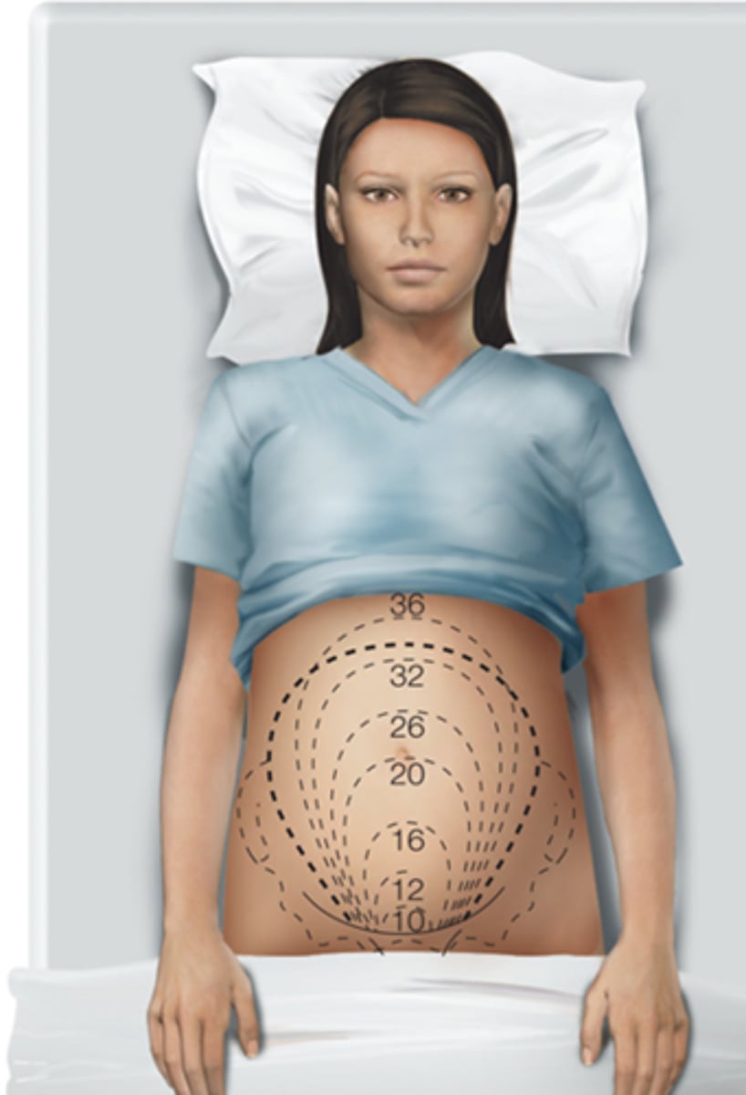 <p>should be firm and located at or near the level of the umbilicus</p>