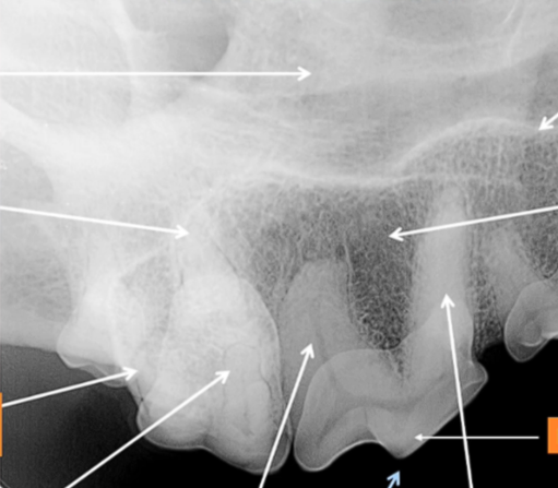<p>Normal Dental Radiography - arrows meaning?</p>