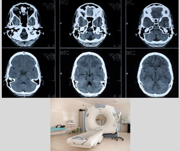 <p>combines a series of X-ray imaged taken from different angles around your body and uses computer processing to create cross-sectional imaged (slices) of the bones, blood vessels, and soft tissues inside your body</p>
