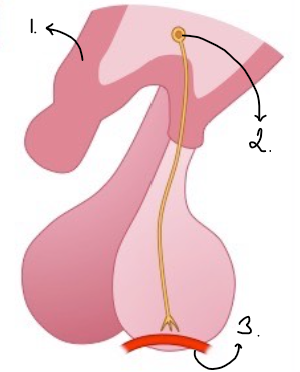 <p>Is this the anterior or posterior lobe+ fill in labels  </p>