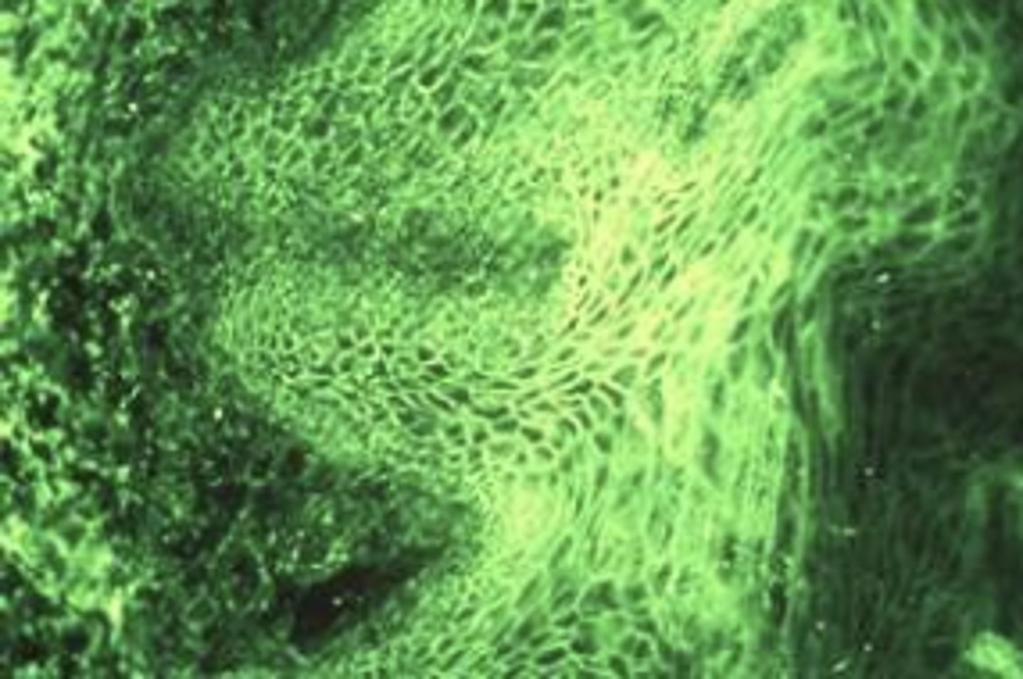 <p>What kind of doctor would you refer a patient with pemphigus?</p>