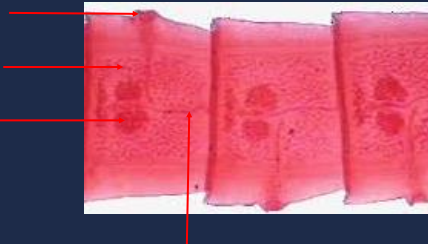 State the name of the structure pointed at the second upper portion of the picture.