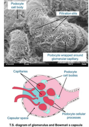 The Bowman’s capsule comprises specialized epithelial cells called podocytes. 

The plasma filtrate passes through the filtration slits between them, but large molecules such as plasma proteins and blood cells remain in the capillaries.