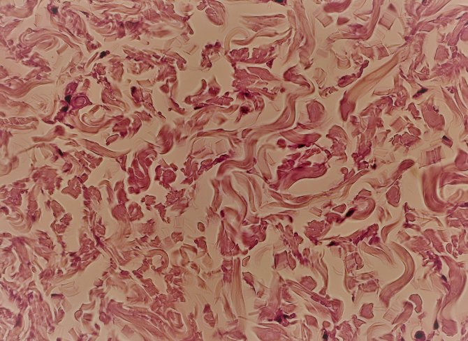 <p>A type of connective tissue that consists of irregularly arranged collagen fibers, providing strength in multiple directions and support to areas such as the dermis of the skin (nonparallel collagenous fibers)</p>