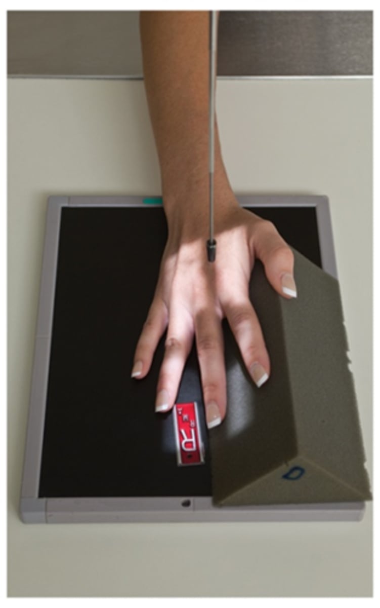 <p>-digit rotated at 45 degrees seen by concavity of the elevated side</p><p>-no superimposition of the proximal phalanx or MCP joint</p><p>-open IP and MCP joint spaces</p>