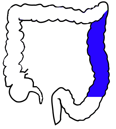<p>descending colon</p>