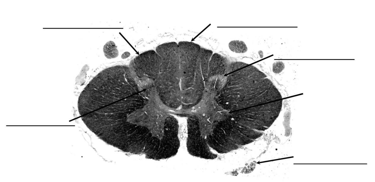 <p>identify this spinal level</p>