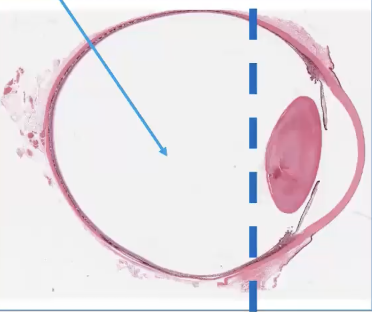 <ol><li><p>vitreous humor</p></li><li><p>retina</p></li><li><p>choroid</p></li><li><p>optic nerve</p></li><li><p>posterior sclera</p></li></ol><p></p>