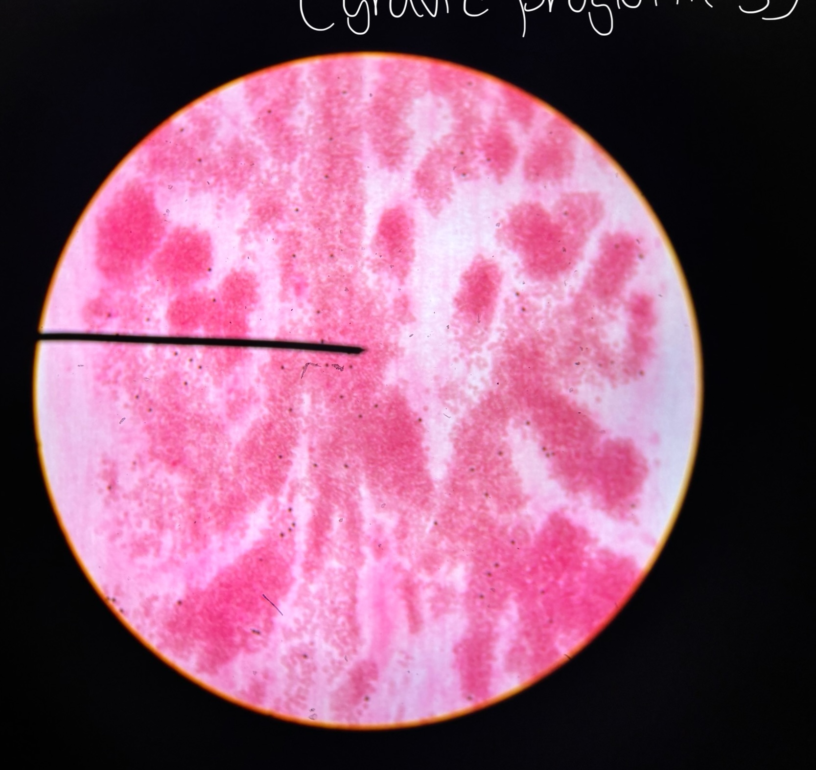 <p>Proglottids passed in long chains, has 7 - 13 lateral uterine branches per side</p>