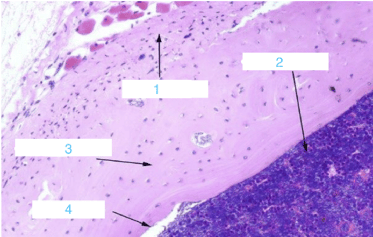 <p>where is the endosteum?</p>