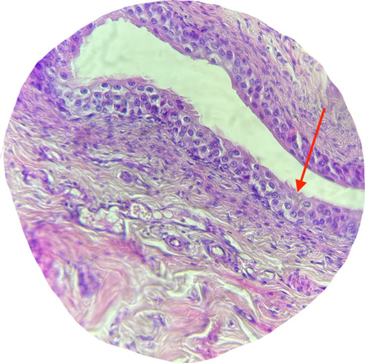 <p>is this transitional epithelium contracted or relaxed?</p>