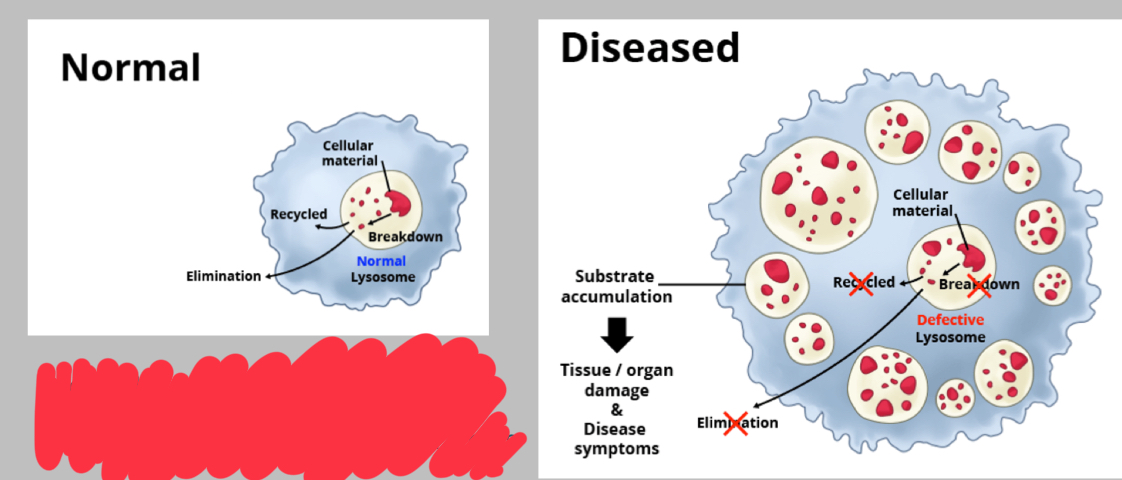 <p>What can cause a lysosome to look this way?</p>