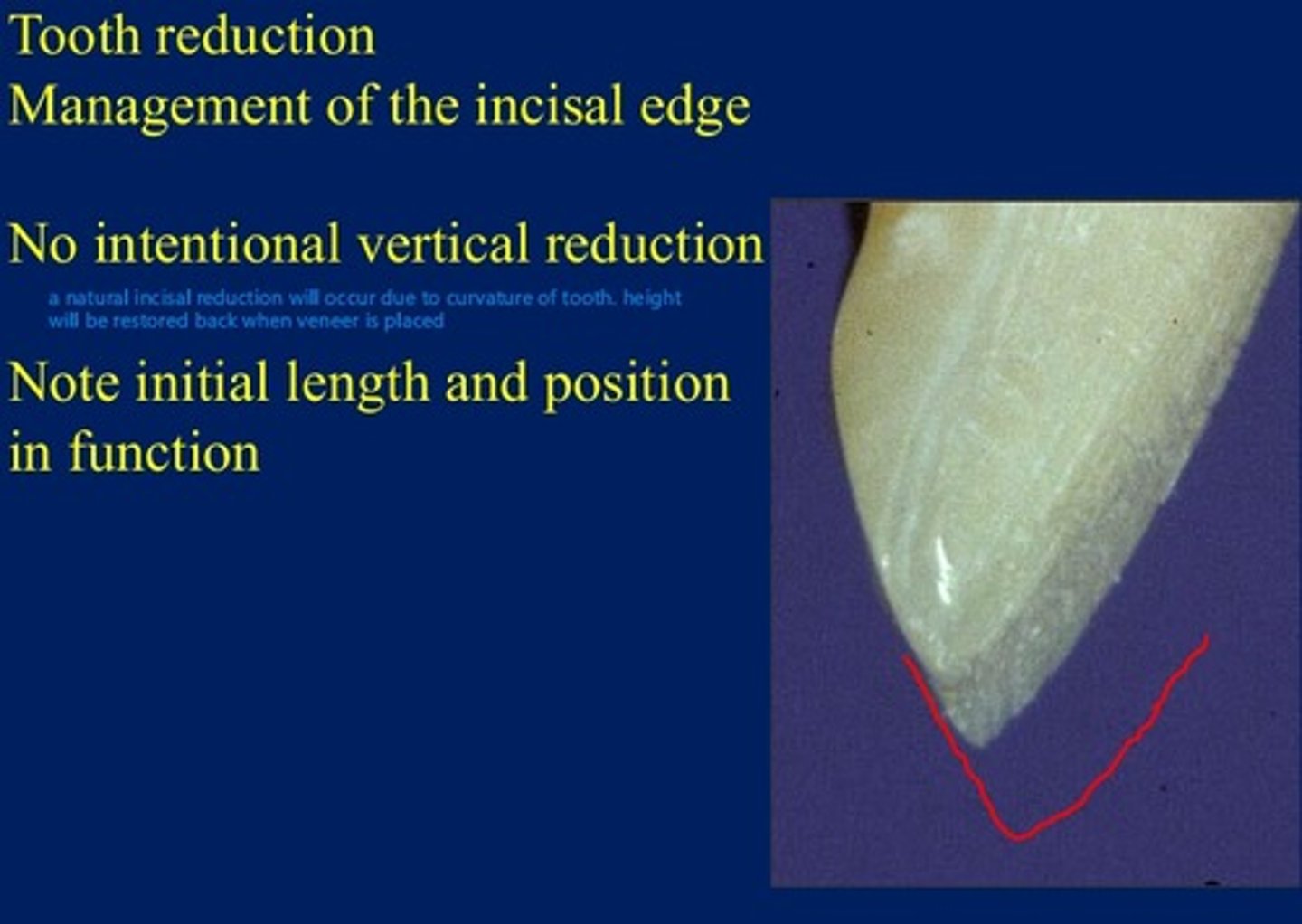 <p>reduce the line angles</p><p>include al lvisible proximal surface</p><p>do NOT break contact</p><p>"exact representation of anatomy of tooth prior to starting"</p><p>no INTENTIONAL vertical reduction of incisal edge</p><p>( note some reduction will occur naturally as a result of the contour of the tooth)</p>
