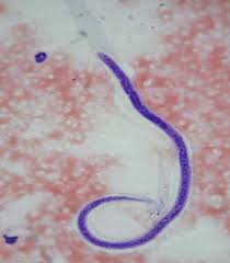<p>in human blood </p><p>lymphedemia</p><p>tropic/subtropics of Asia, Africa, Western Pacific, Caribbean, South America</p>