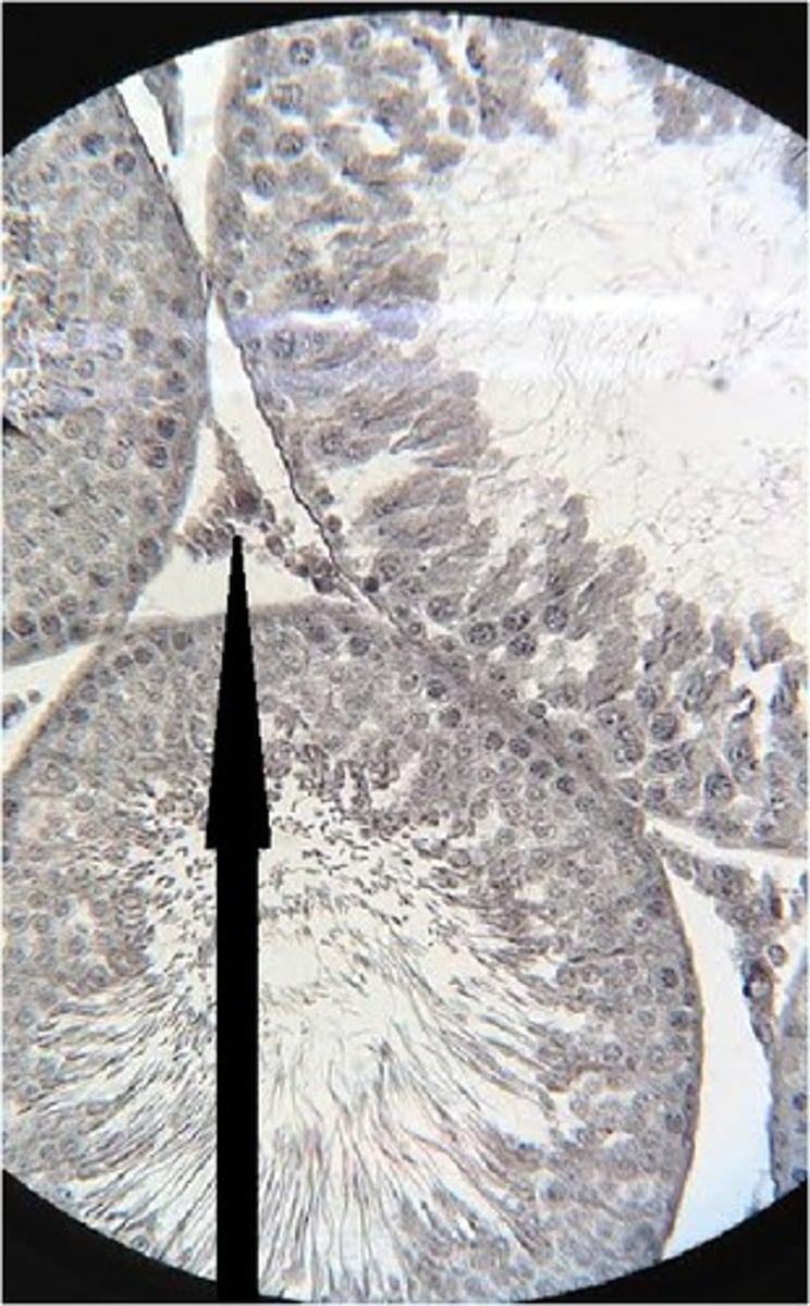 <p>A. Label B. Hormones made there</p>