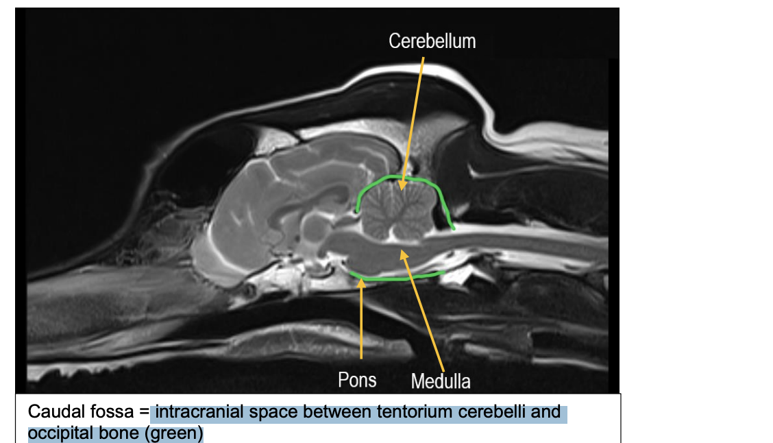 <p>caudal fossa</p>