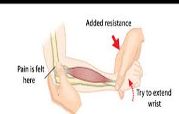 <ul><li><p><strong>lateral epicondylitis / tennis elbow</strong></p></li><li><p>palpate just below lateral epicondyle of elbow; apply pressure w/ hand to dorsum of pt’s fist forcing it into flexion</p></li><li><p>positive = pain on outside of elbow when hand is extended at wrist against resistance</p></li></ul><p></p>