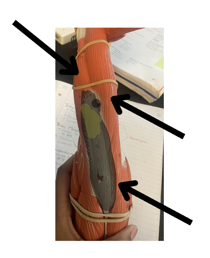 <p>What is this?(Not the black fill in)</p>