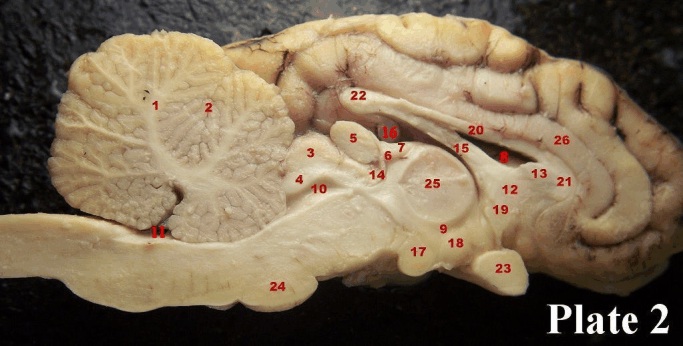 <p>#11</p>