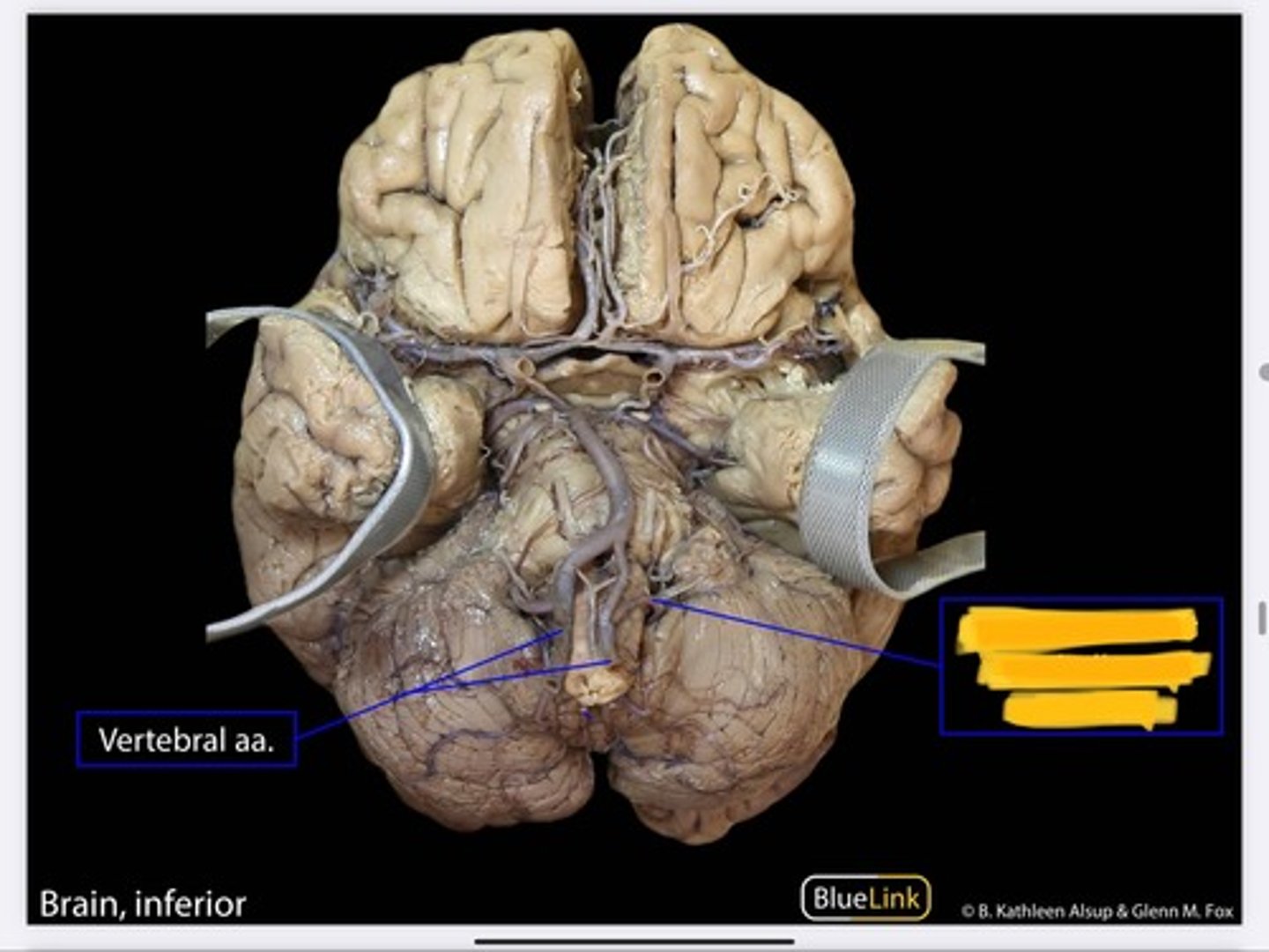 knowt flashcard image