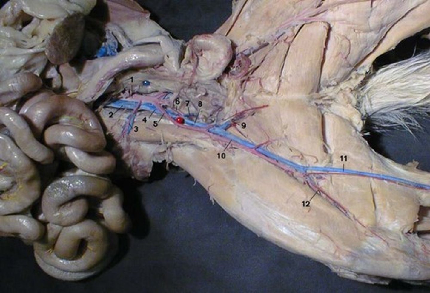<p>What nerve runs along with the vessels of #11?</p>