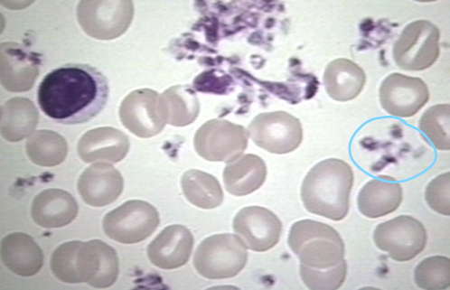 <p>-derived from megakaryocytes</p><p>-terminally differentiated</p><p>-contains granules</p><p>-does not contain nucleus</p><p>-involved in clotting</p>