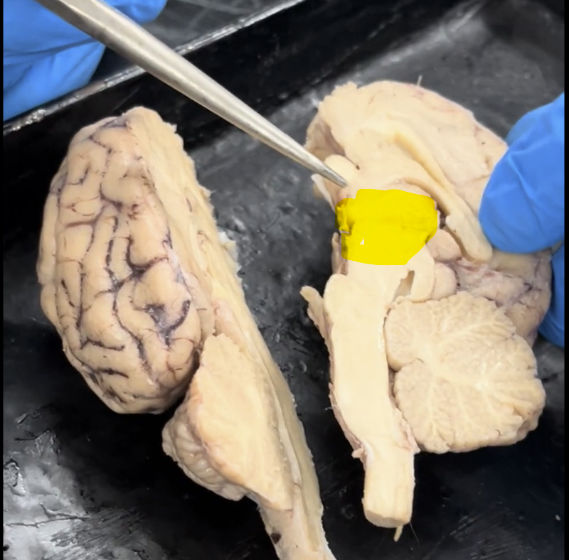 <p>What is this portion of the brain called (contains both the thalamus and the hypothalamus)?</p>