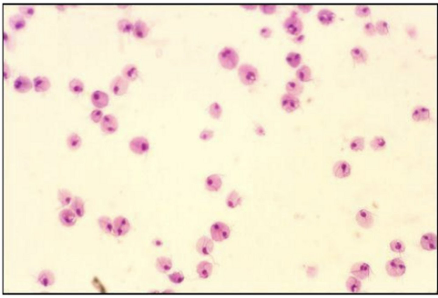 <p>Trichomonas vaginalis - trophozoite</p>