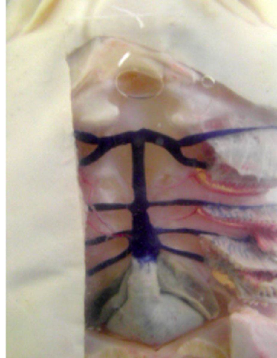<p>conduct blood from the ventral aorta to the gills</p>