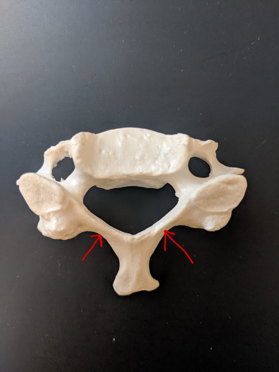 <p>Name this structure</p>