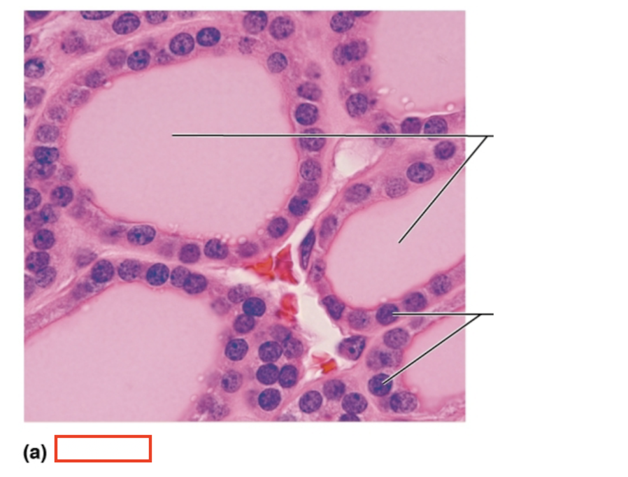 <p>What tissue is shown? </p>