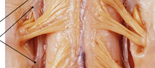 <p>What part of the pia mater:</p><ul><li><p>Anchors spinal cord</p></li><li><p>Prevents lateral movement</p></li></ul><p></p>