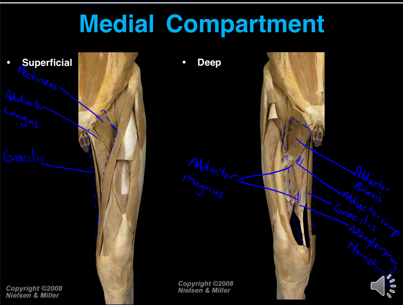 <ul><li><p>Gracilis</p></li><li><p>Pectineus</p></li><li><p>Adductor longus, brevis</p></li><li><p>Adductor magnus</p></li><li><p>Obturator externus</p></li></ul><p></p>