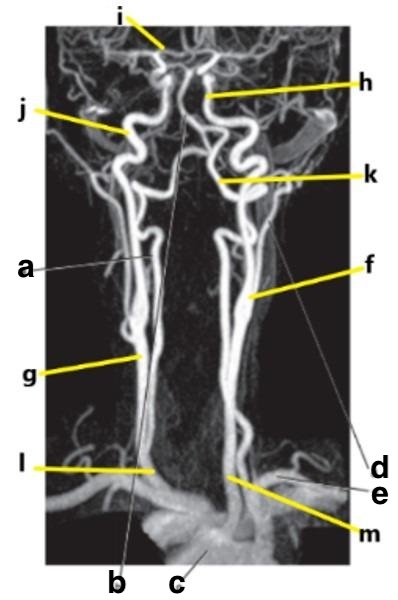 <p>What is letter m?</p>